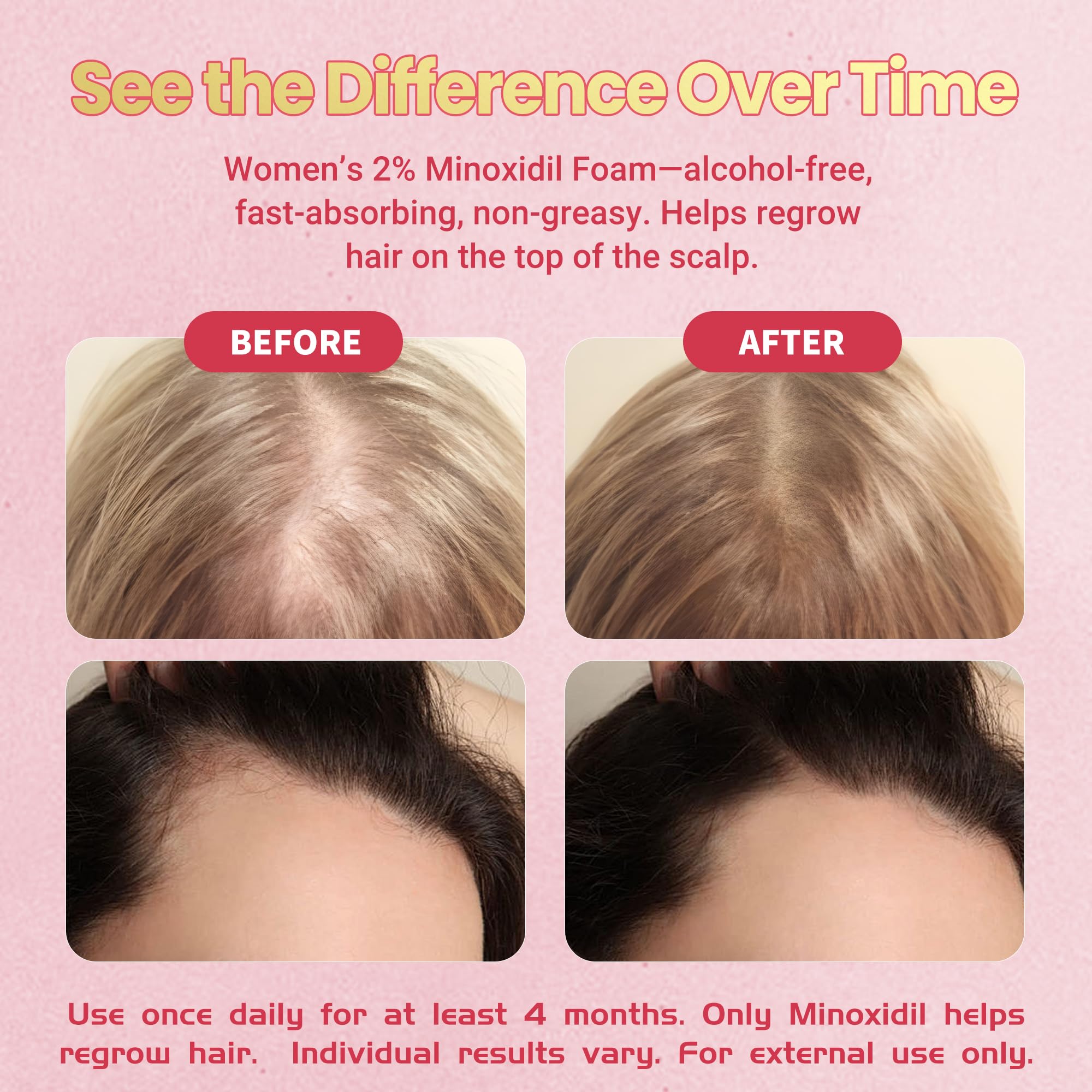Gemächlich Zu Hause minoxidil foam shown as unscented, suitable for sensitive scalps.