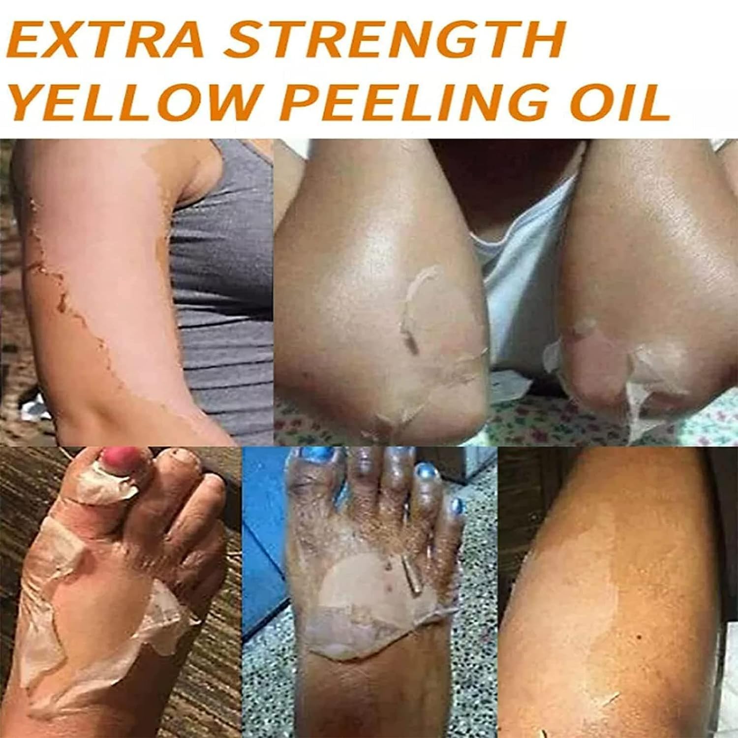 Generic Extra Strong Yellow Peeling Oil with hyaluronic acid provides post-exfoliation moisture.