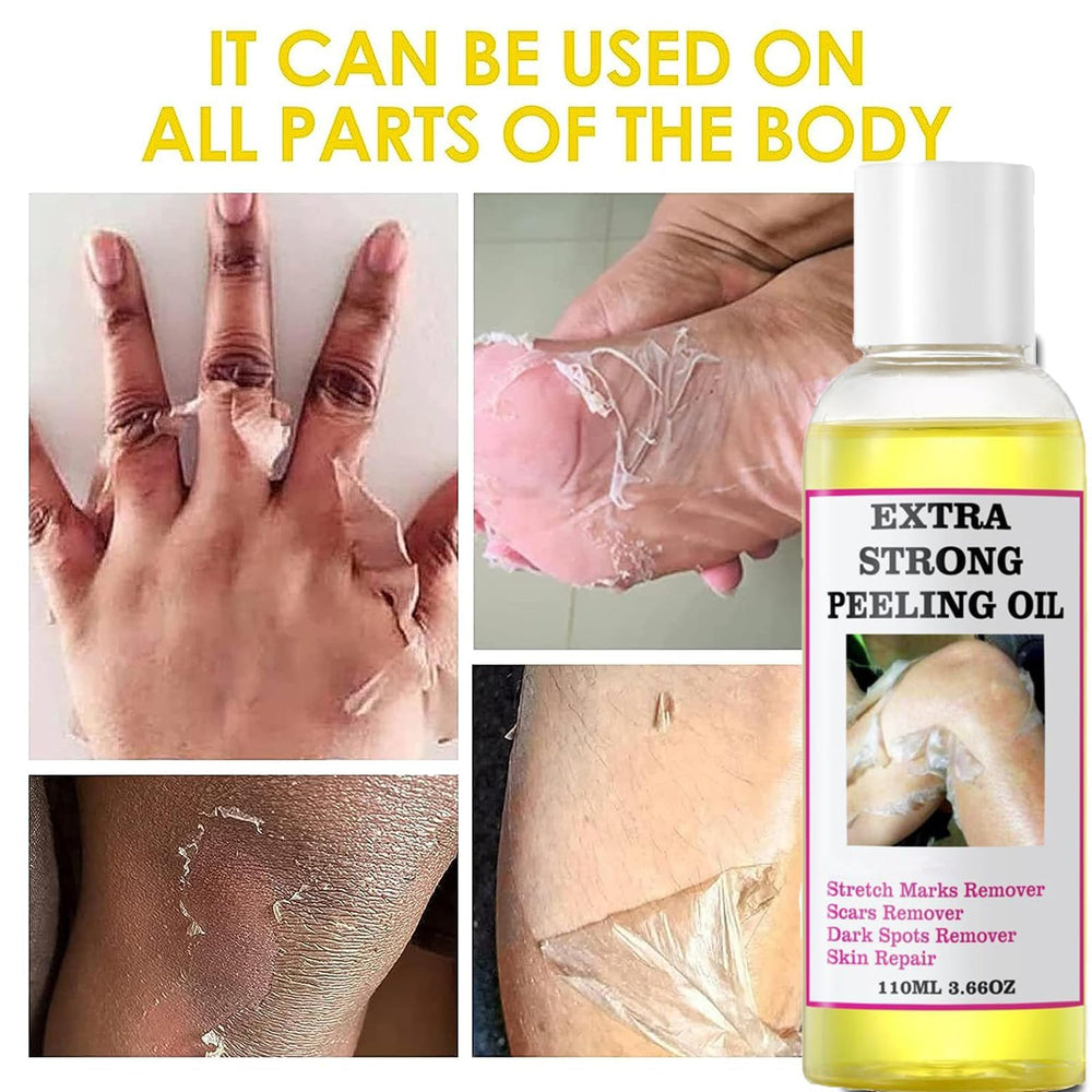 Generic Extra Strong Yellow Peeling Oil ingredients citrus extract close-up.
