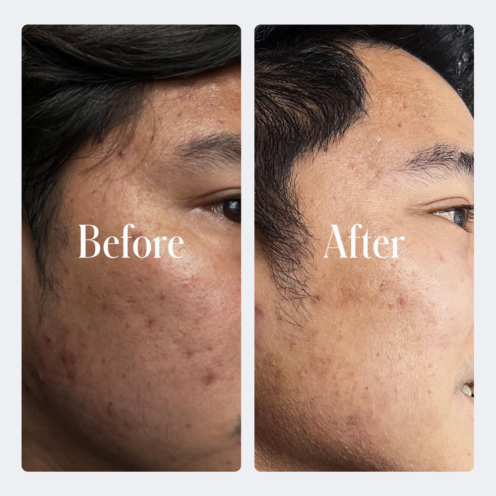 Geologie Retinol application night routine showing simple steps for evening care.