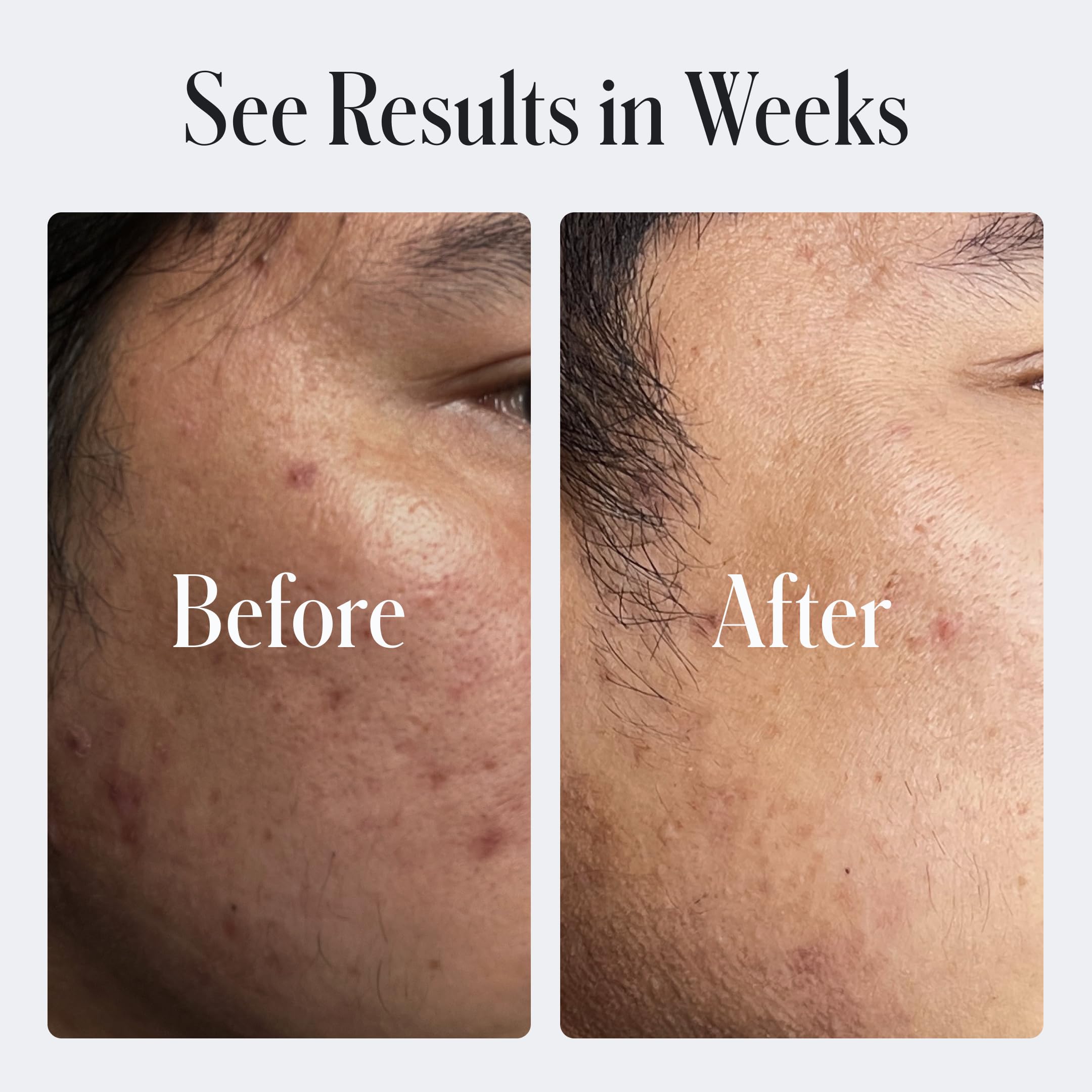 Geologie Skin Repair Moisturizer Hyaluronic Acid close-up emphasizing deep hydration.