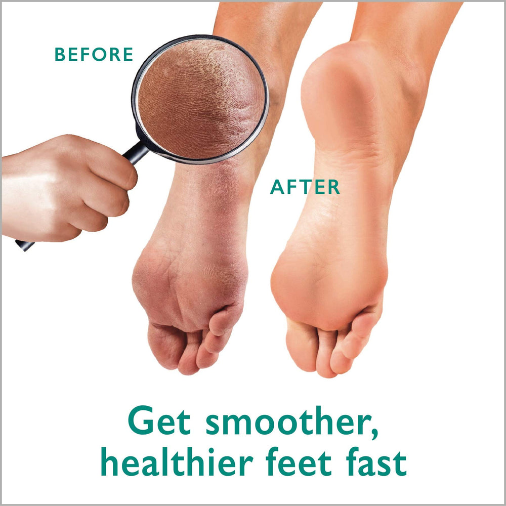 GILDEN TREE full kit encourages routine foot care for soft heels and smooth skin.