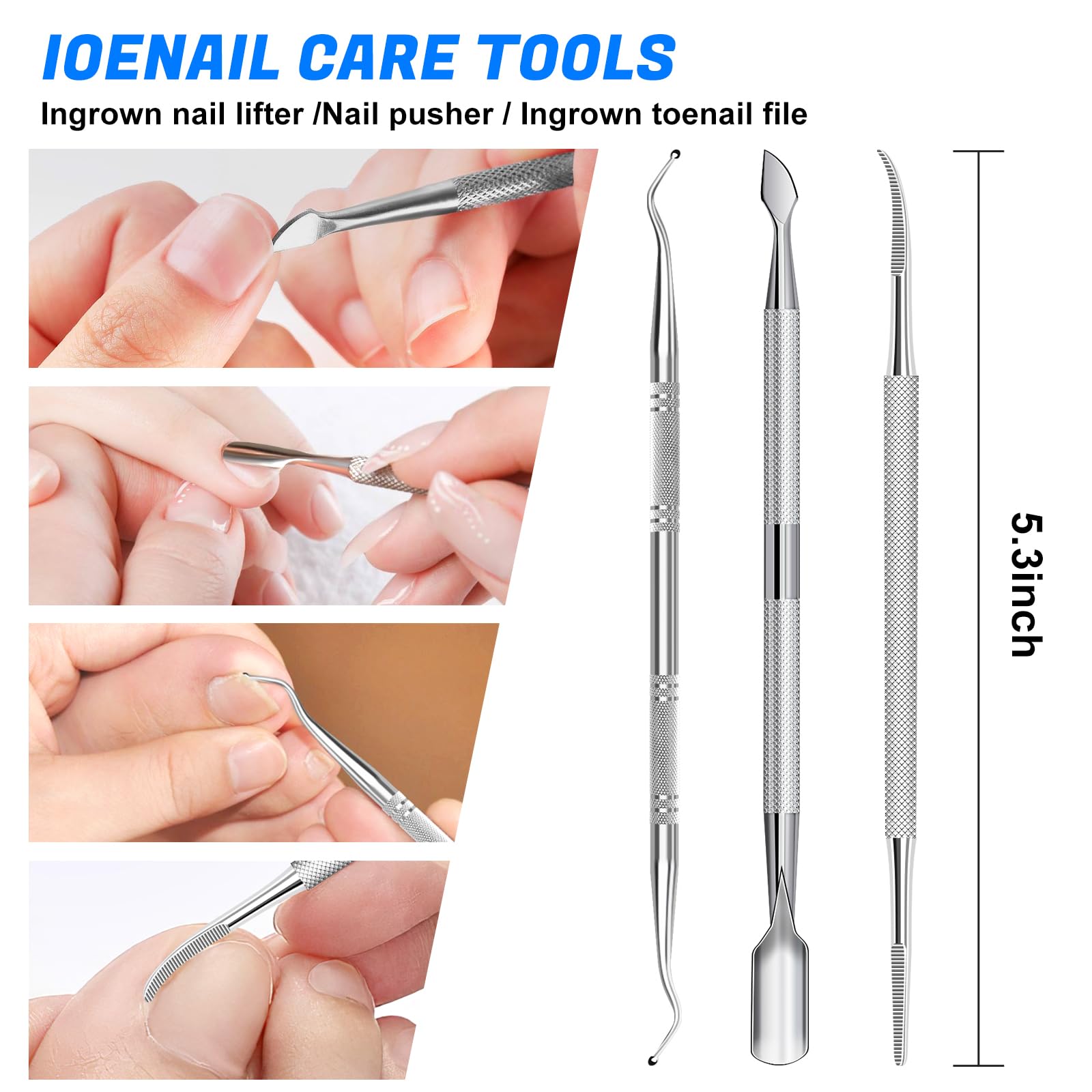 GJNL ingrown nail lifter supports gentle nail lifting before trimming