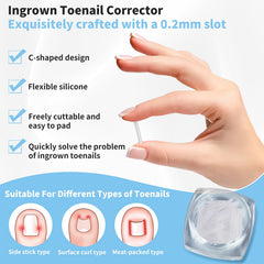 GJNL ingrown toenail lifter and small scissors included in kit