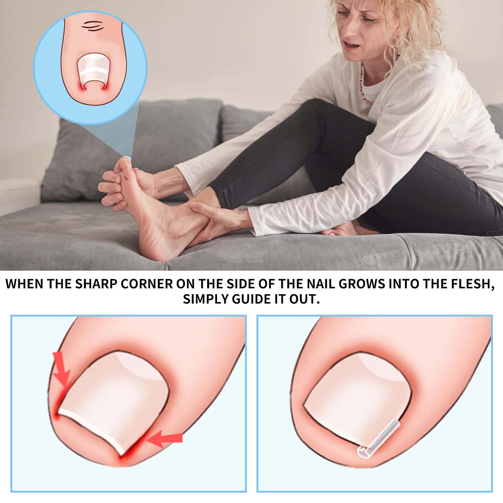 GJNL ingrown toenail strip ultra-thin 0.2mm material for comfortable wear