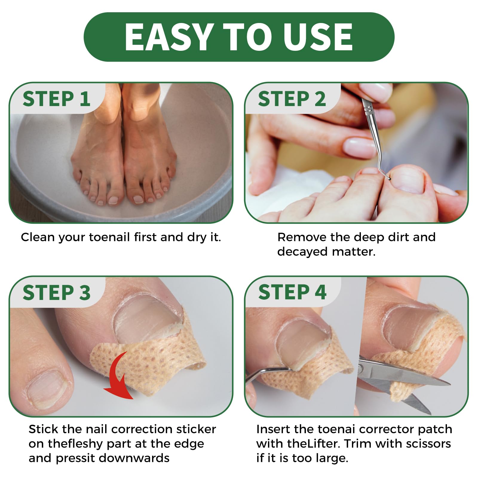 GJNL toenail storage case keeps tools organized and portable for home pedicures.