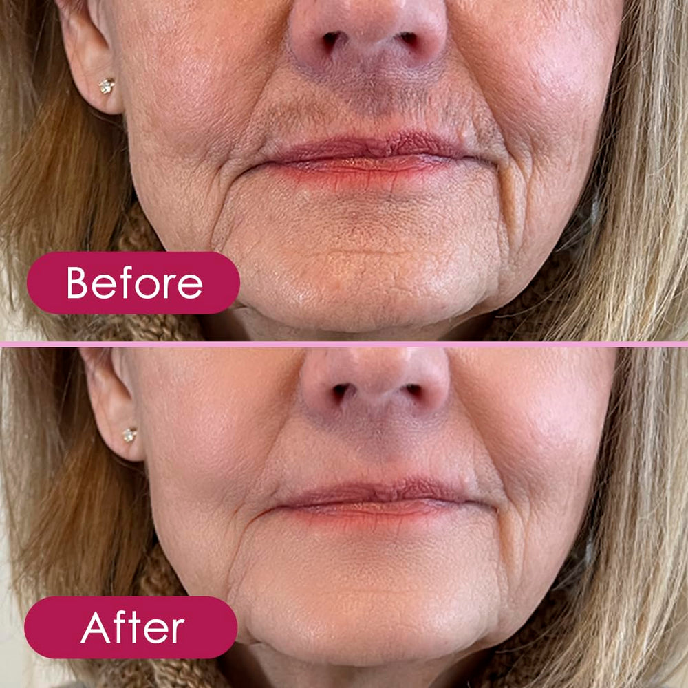 Glabrous Skin epilator silky-skin result suggesting lasting smoothness.