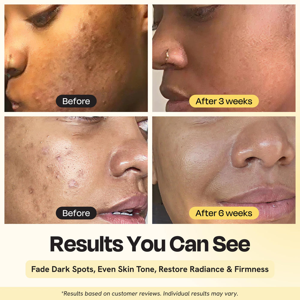 Gleamin Superactive Serum label detail shows 15% Vitamin C and clean formulation