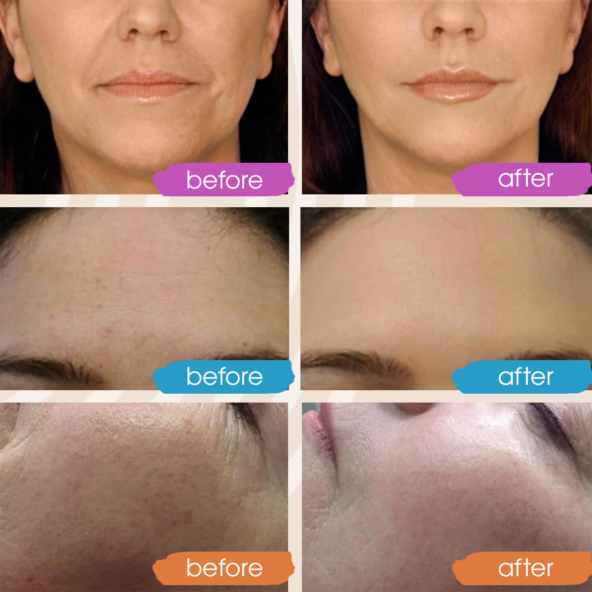 GLEOW hyaluronic acid hydrating serum being applied for supple skin