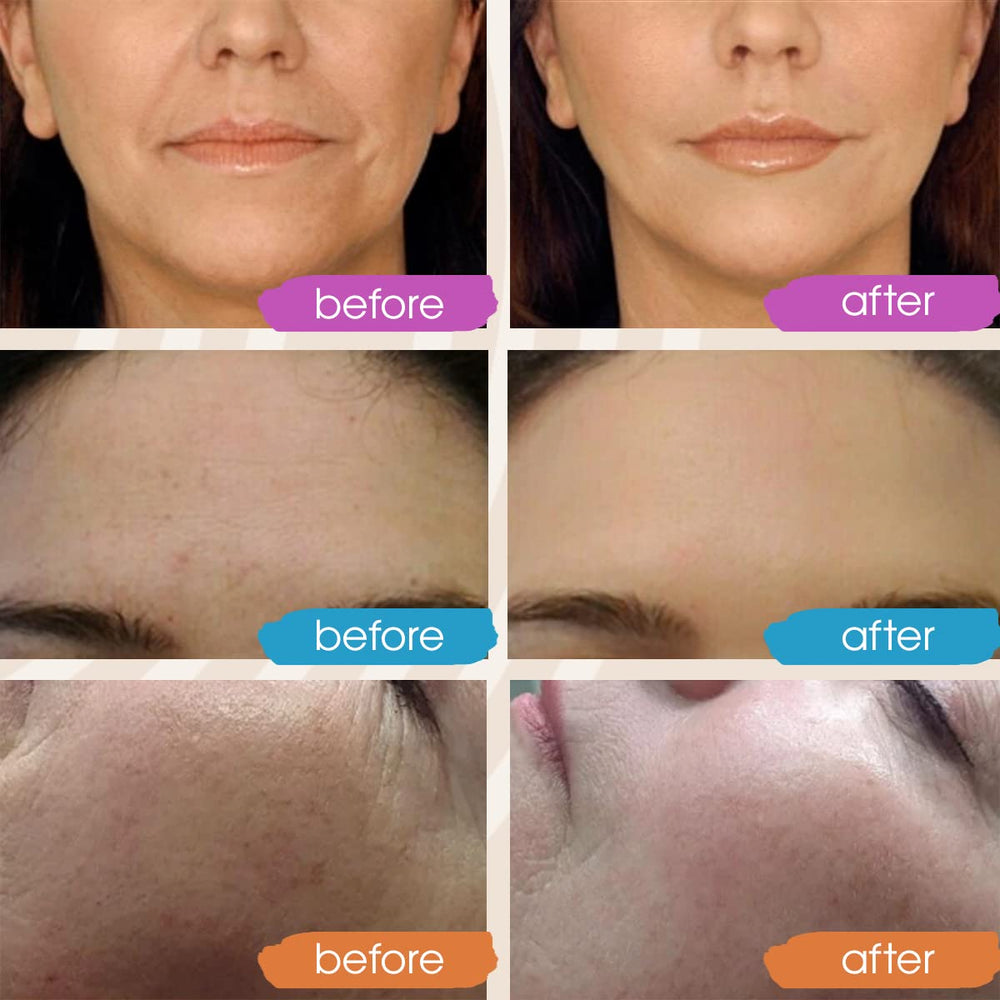 GLEOW hyaluronic acid hydrating serum being applied for supple skin