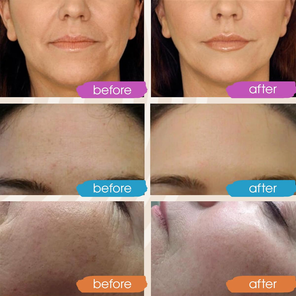 GLEOW hydration glow closeup on cheek showing dewy, radiant skin.