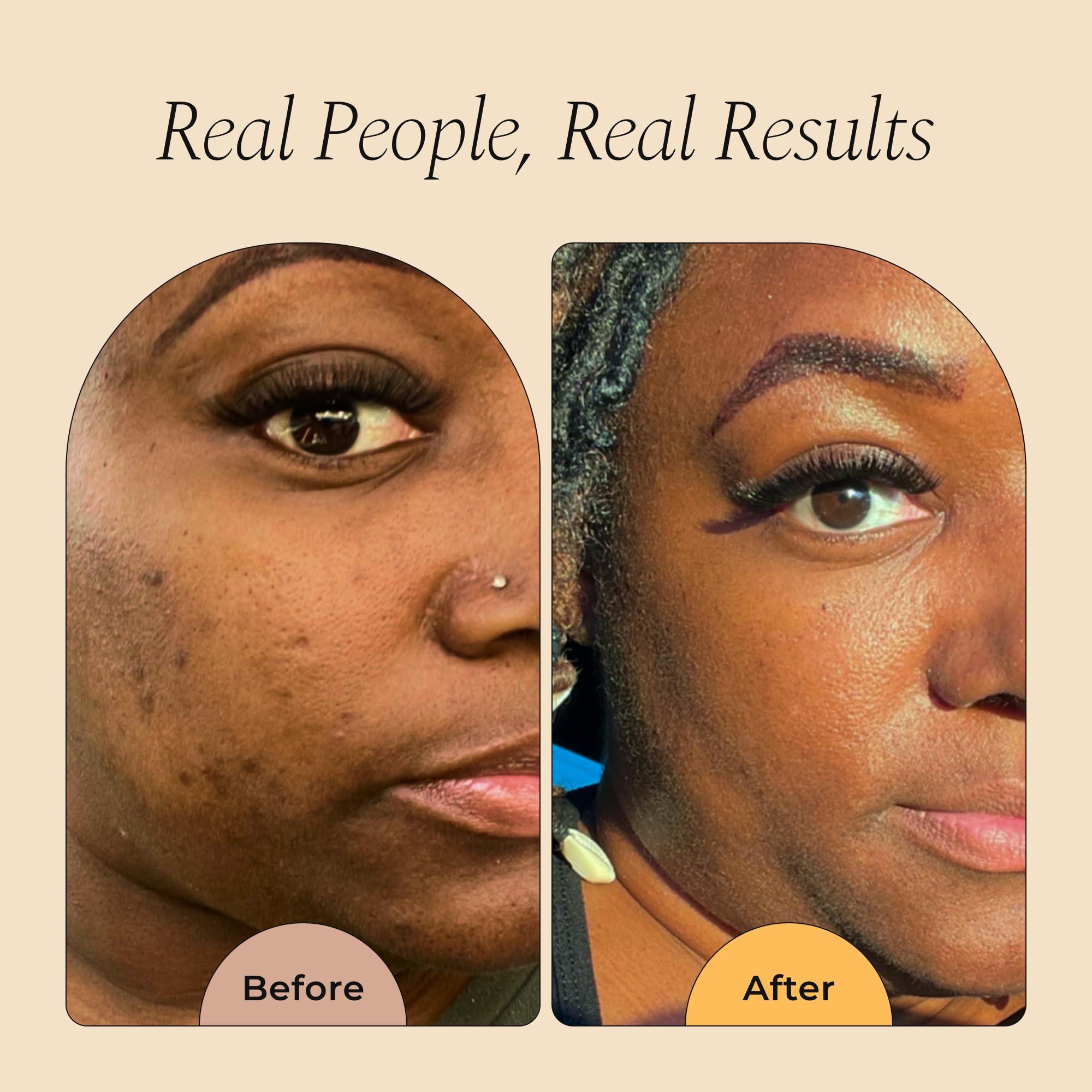 Glo Melanin Turmeric Scrub face application for gentle brightening.