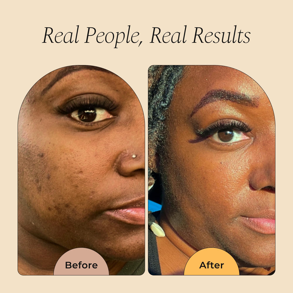 Glo Melanin Turmeric Scrub face application for gentle brightening.