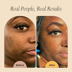 Glo Melanin Turmeric Scrub face application for gentle brightening.