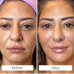 Glov Beauty Hyaluronic Ampoules offer hydrating, plumping peptides.