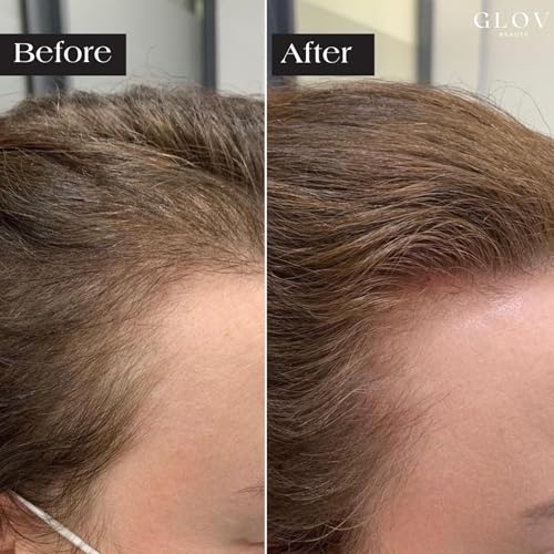 Glov Beauty serum ampoules 5 ml showing peptide hyaluronic blend
