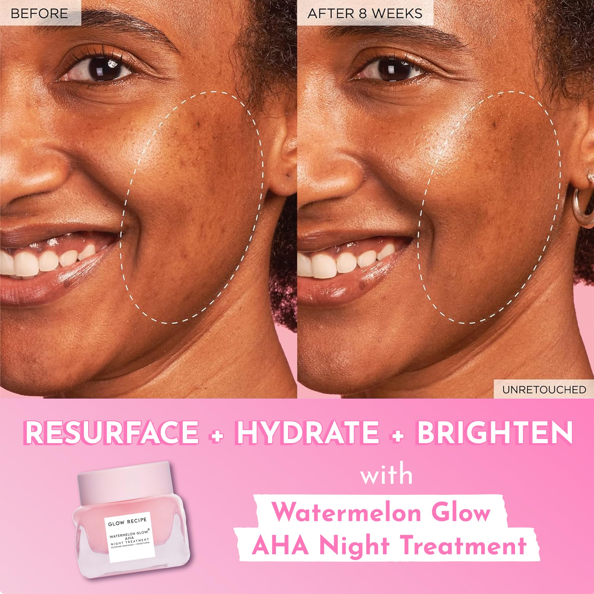 Glow Recipe Watermelon Glow Night Treatment hyaluronic acid close-up demonstrates deep hydration