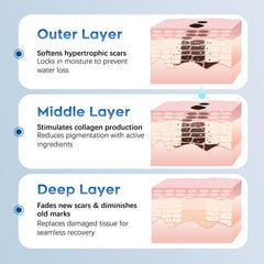 Glowor silicone scar gel on the body showing broad scar coverage use case