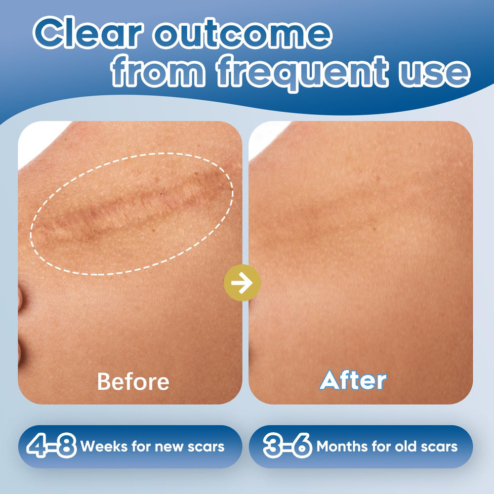Glowor silicone scar gel bottle with botanical ingredients emphasis