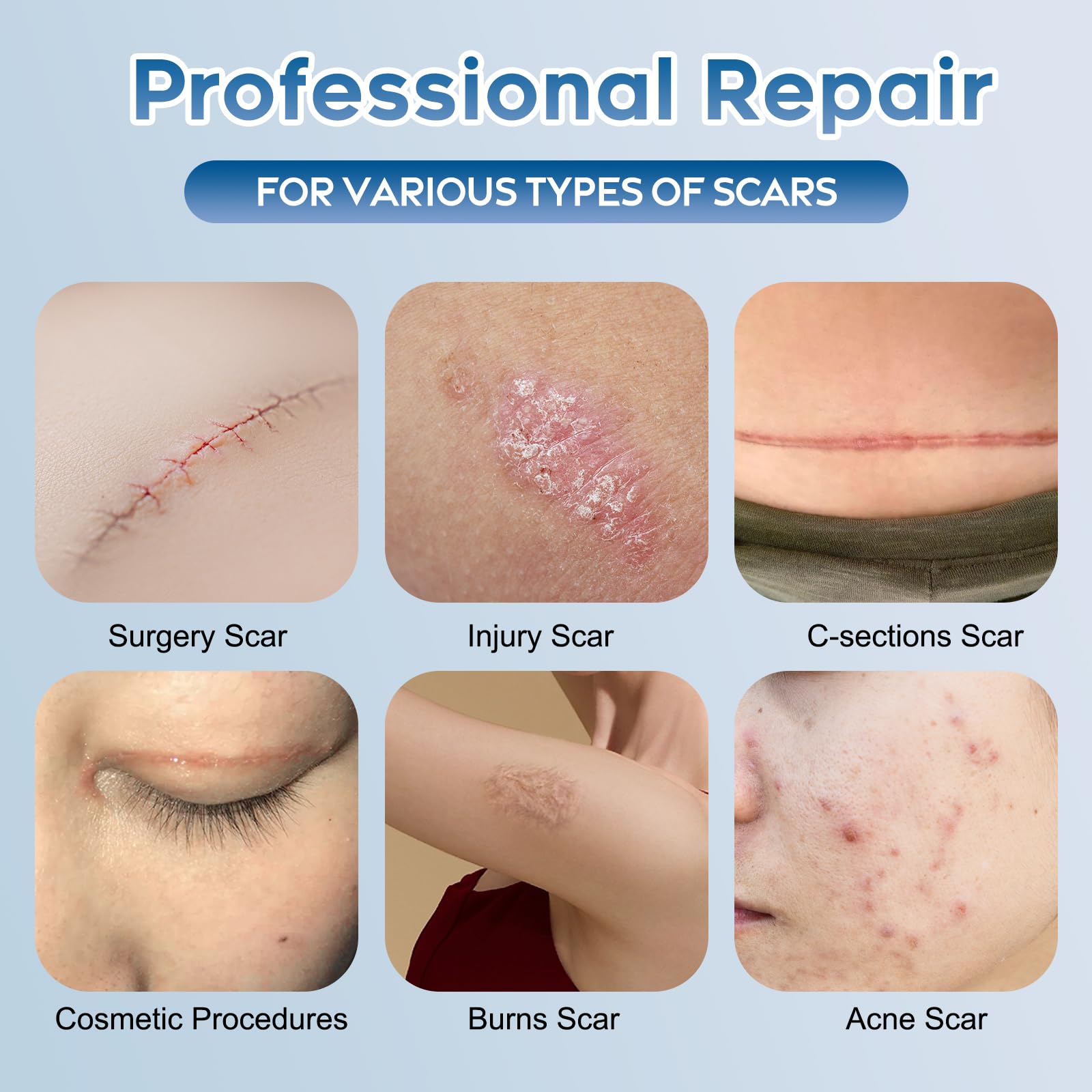 Glowor silicone scar gel texture close-up highlighting smooth, fast-absorbing formula