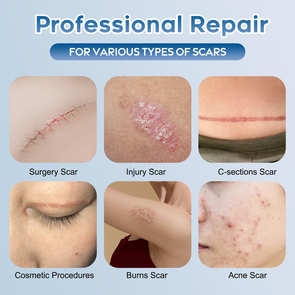 Glowor silicone scar gel texture close-up highlighting smooth, fast-absorbing formula