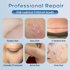 Glowor silicone scar gel texture close-up highlighting smooth, fast-absorbing formula
