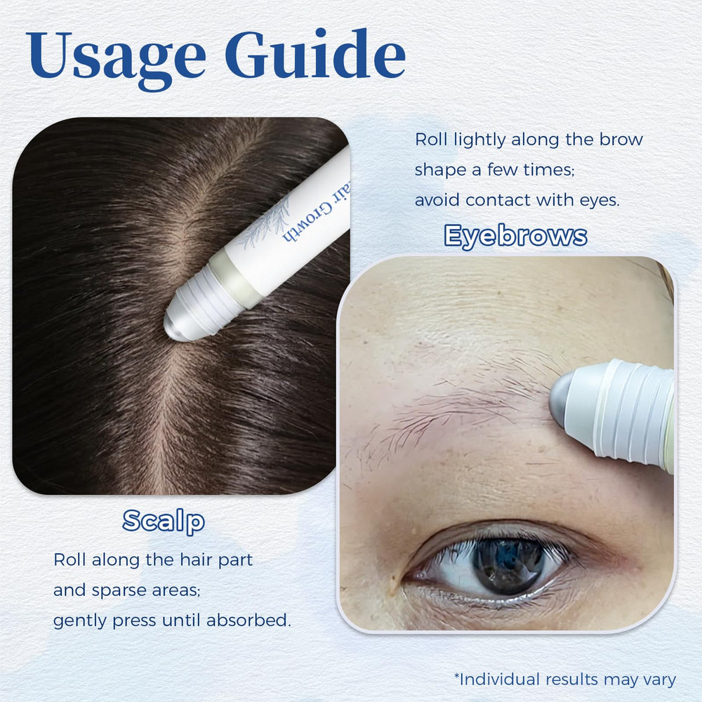 Before and after results using Gluvelessia Hair Growth Serum Roll-On for hair growth.