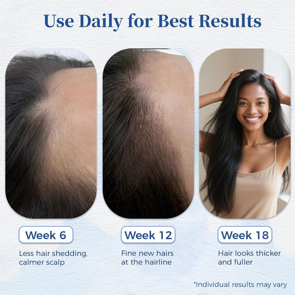 User applying Gluvelessia Hair Growth Serum Roll-On to thinning hair areas for better coverage.