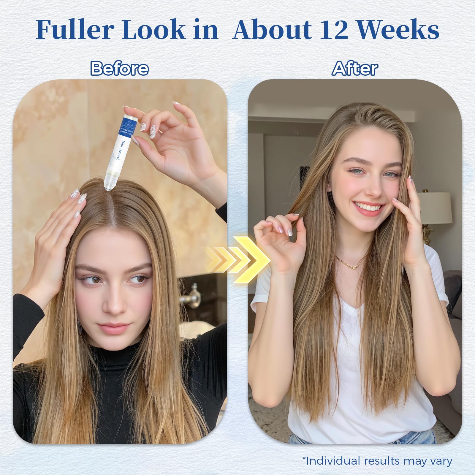 Gluvelessia Hair Growth Serum Roll-On shown in use for effective scalp treatment.
