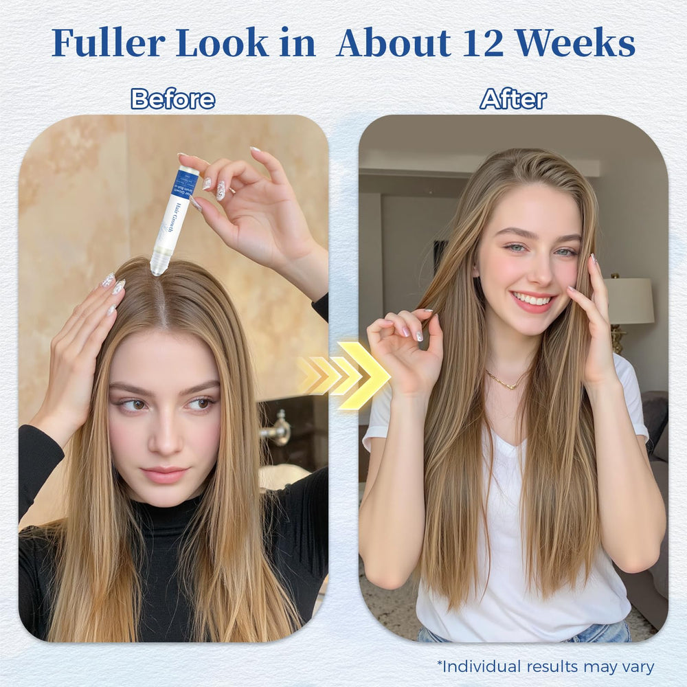 Gluvelessia Hair Growth Serum Roll-On shown in use for effective scalp treatment.