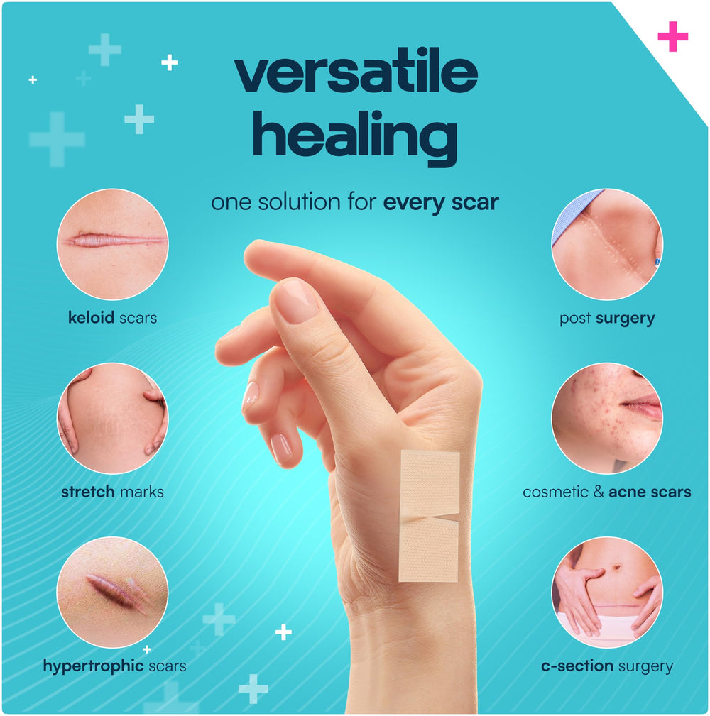 GoGleefy silicone scar roll 60in applying demonstrates cut-to-fit usability