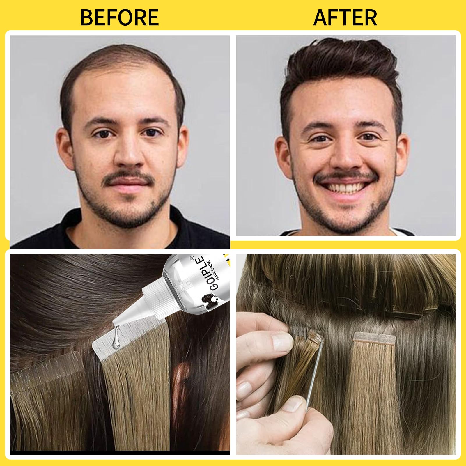 Goiple residue free hairline rescue ensures smooth removal without tugging