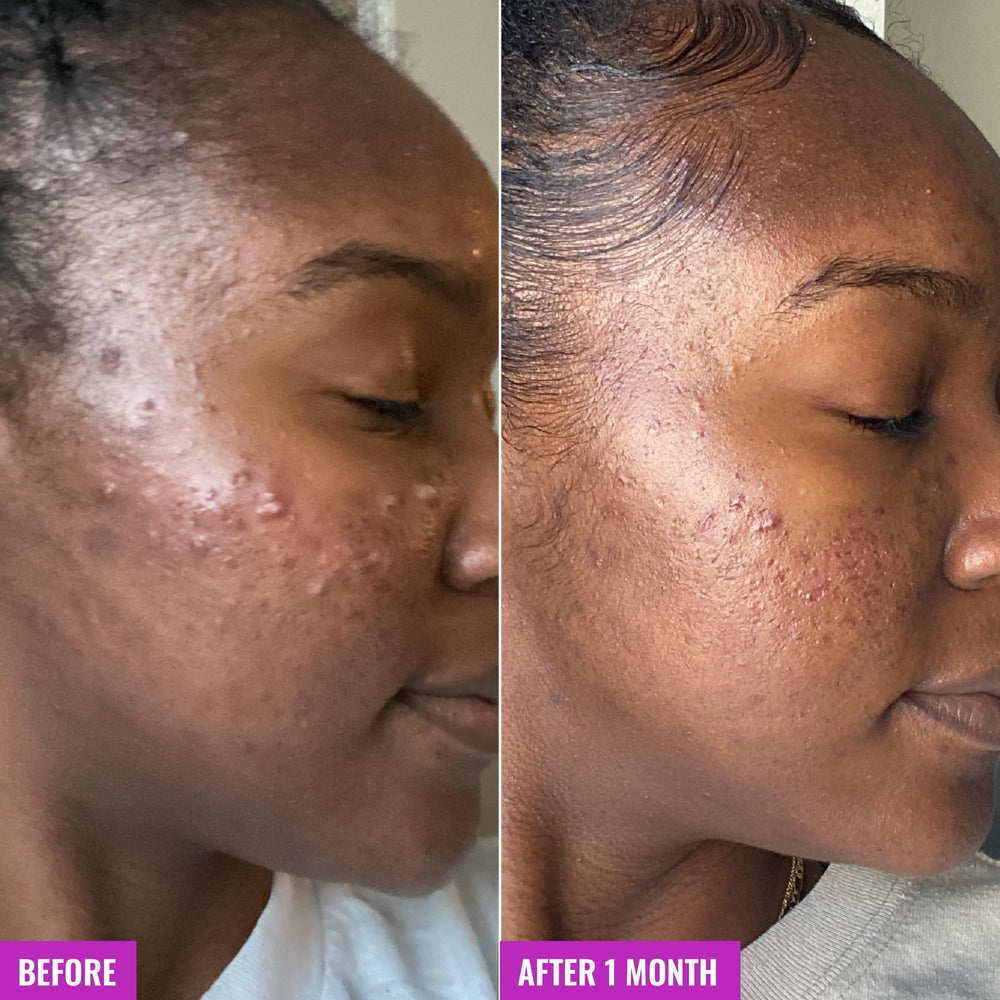 Good Molecules Acne Foaming Cleanser setup beside other skincare products