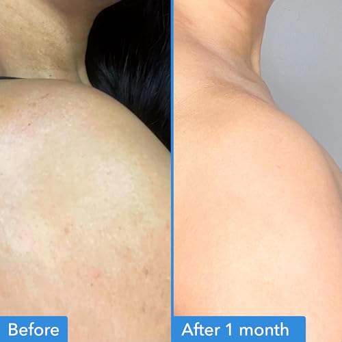 Good Molecules Discoloration Body Treatment cream-tube-front displays a nourishing blend for brightening and smoothing.