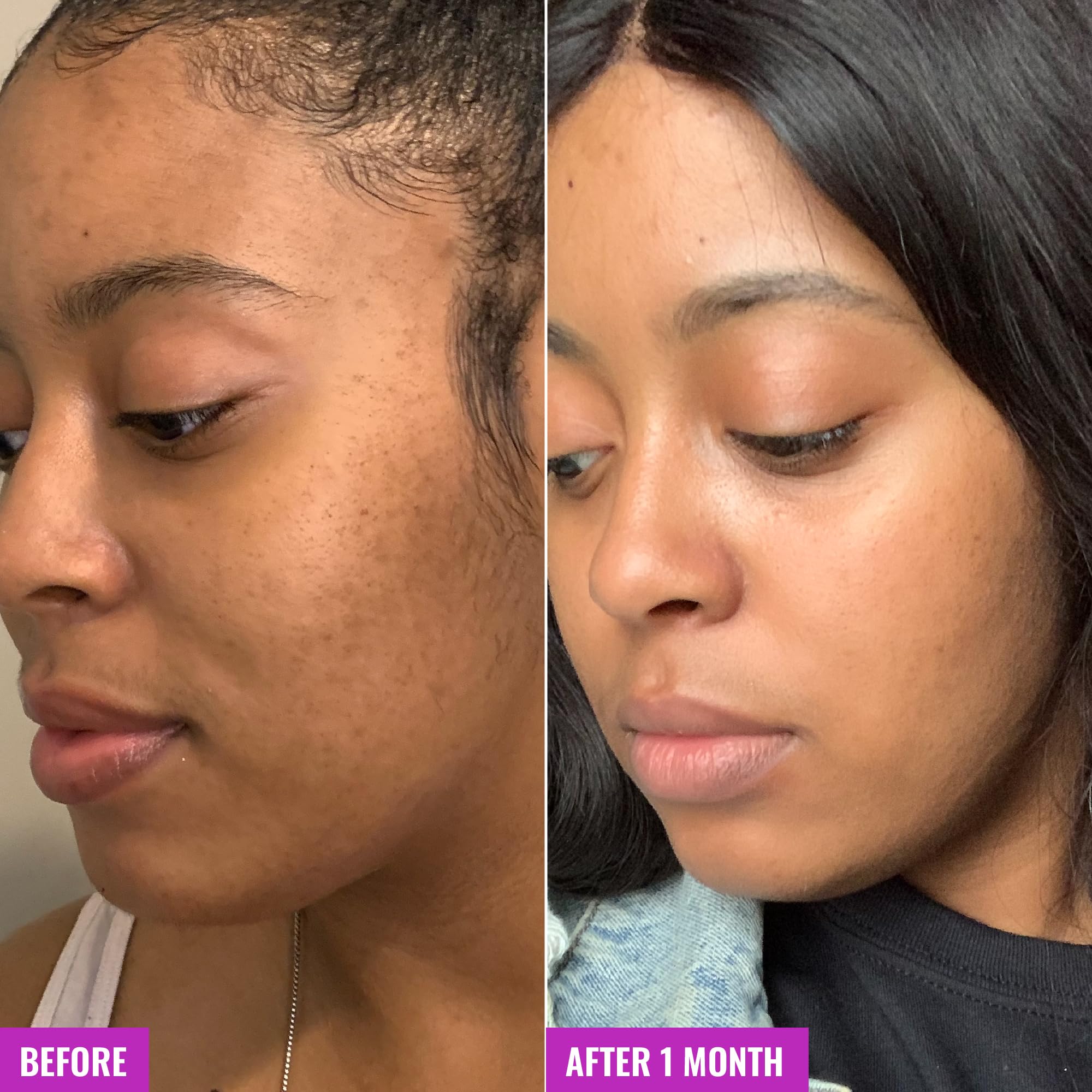 Using Good Molecules Glycolic Exfoliating Toner on a cotton pad for an easy skincare routine.