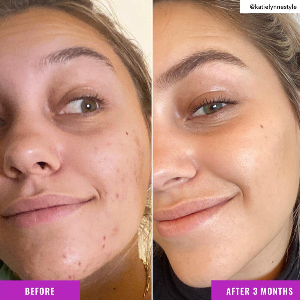 Good Molecules Niacinamide Brightening Toner contains Niacinamide and Arbutin for glow.