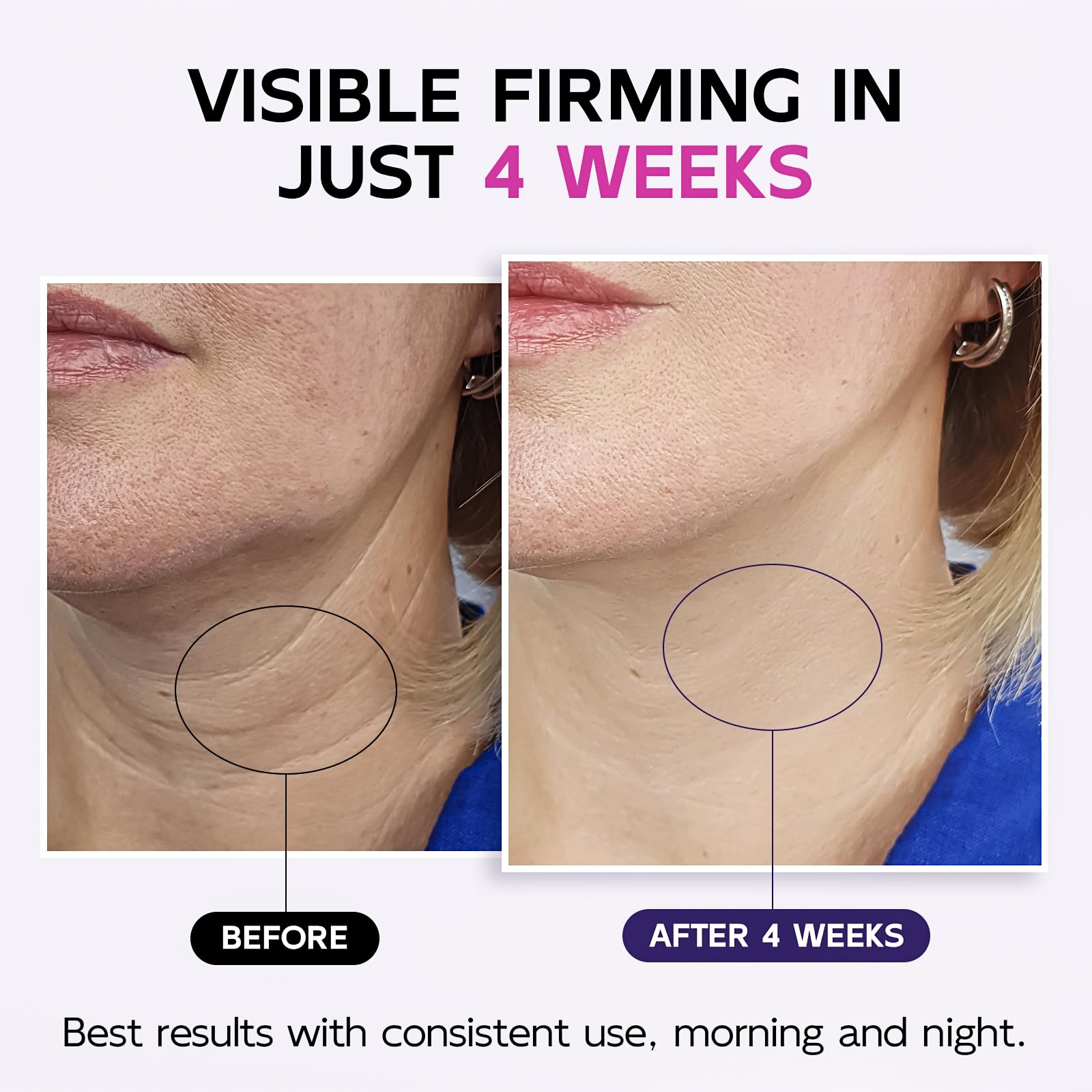 GOOSURE neck cream with retinol and hyaluronic acid close-up highlights hydrating, plumping formula.
