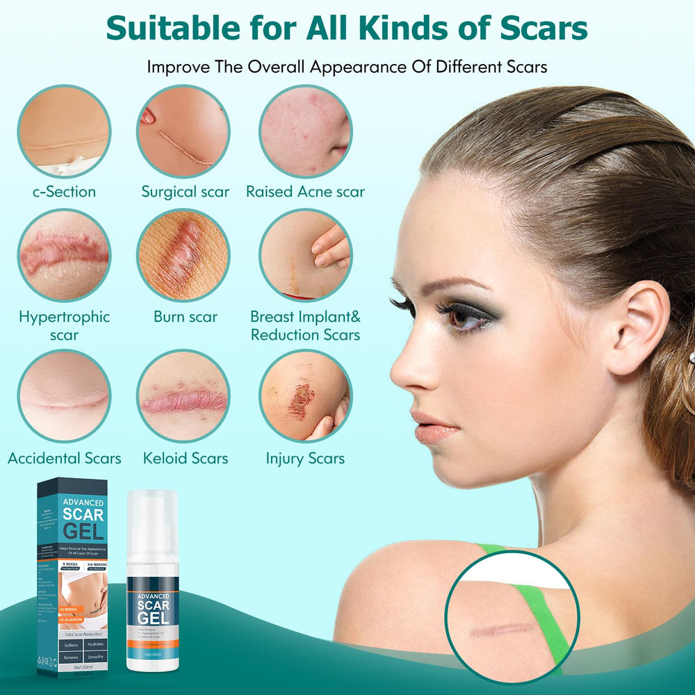 Gowgaw Scar Gel used on the body supports scar care across arms, legs, and back.