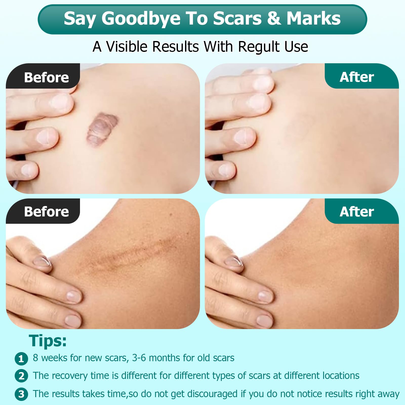 Gowgaw Scar Gel addresses old and new scars for improved appearance.