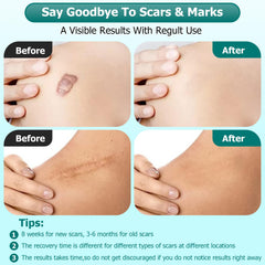 Gowgaw Scar Gel addresses old and new scars for improved appearance.