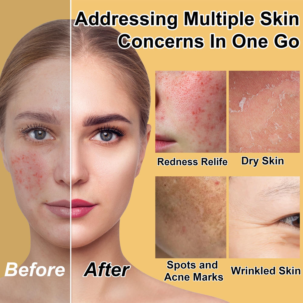 GOWLAVER Skin Care Set toner image—hydrating balance for clean, supple skin.