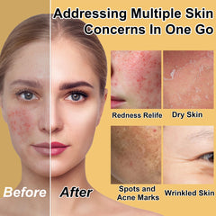 GOWLAVER Skin Care Set toner image—hydrating balance for clean, supple skin.