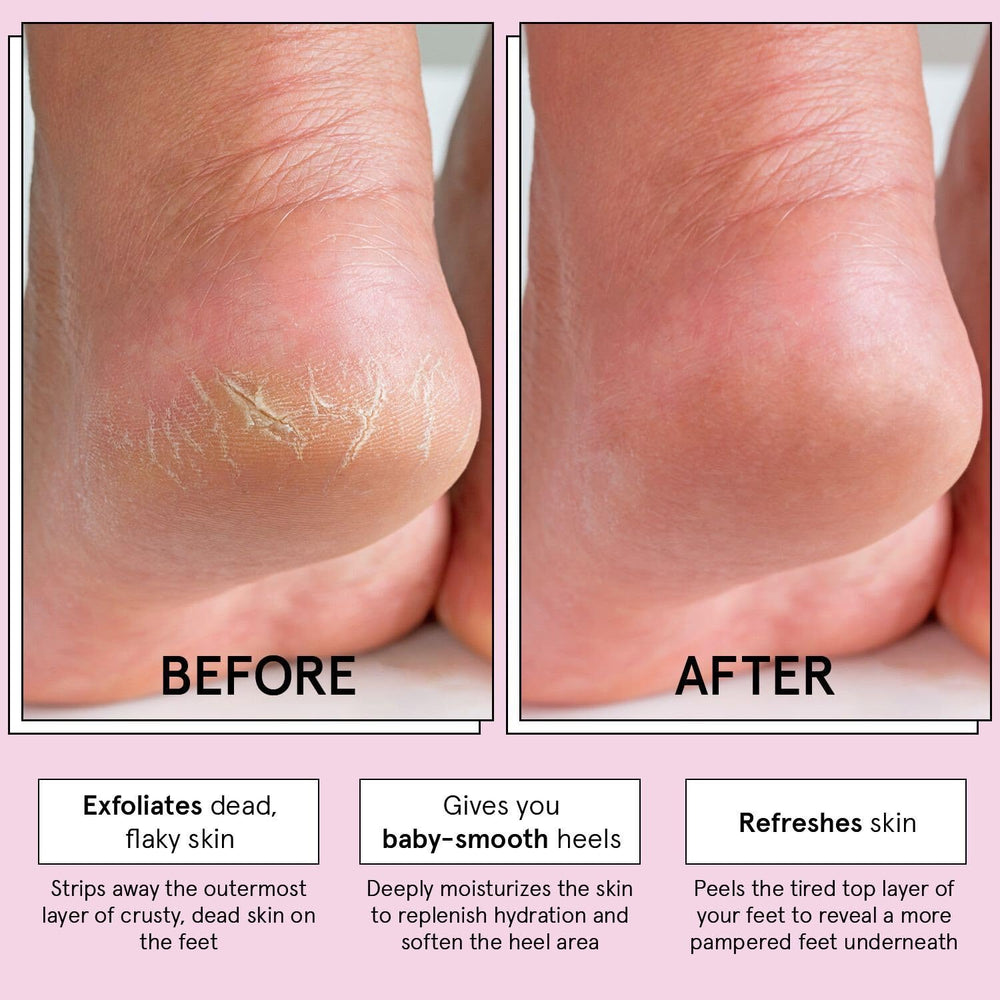 Grace & Stella foot peel mask pair booties demonstrate easy at-home foot treatment.