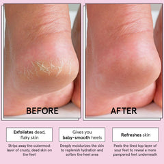 Grace & Stella foot peel mask pair booties demonstrate easy at-home foot treatment.