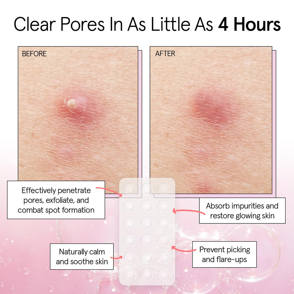 Grace & Stella patches are clear with skin-friendly adhesive for day wear.