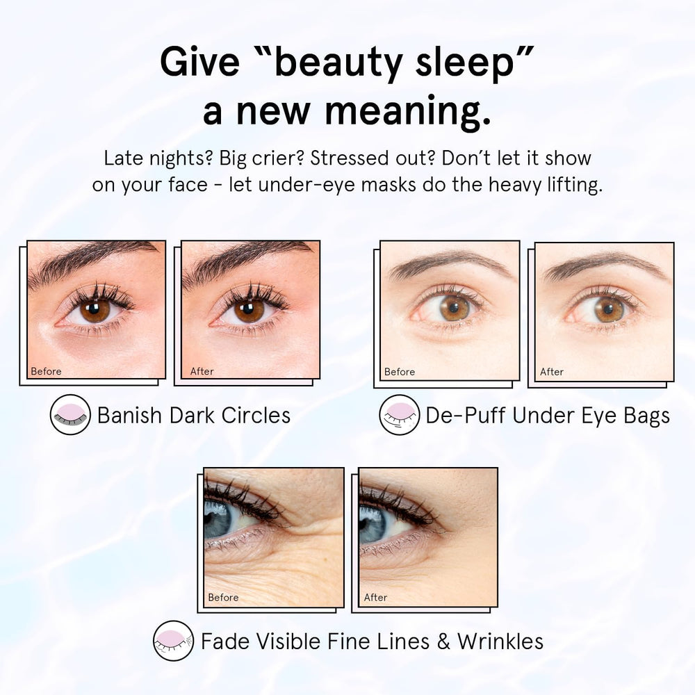 Grace & Stella patches on under-eye area suggesting relief from puffiness.
