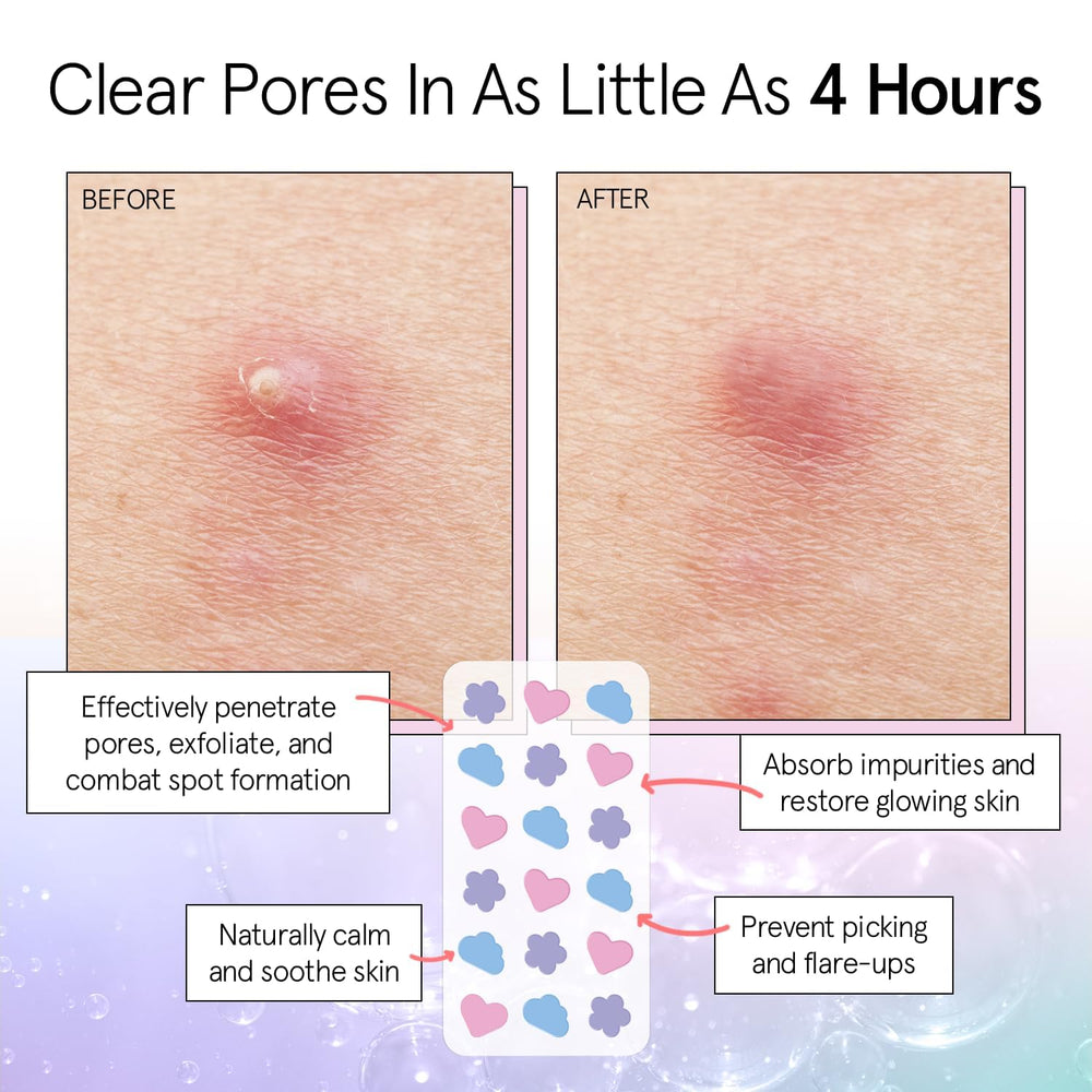 Grace & Stella tea tree oil ingredients closeup highlighting skin-supporting care