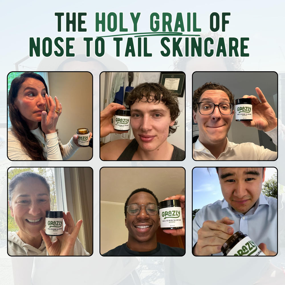 Grazly balm face application demonstrates lightweight hydration for sensitive skin.