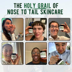 Grazly Balm on Dry Skin shows smooth, non-greasy hydration.