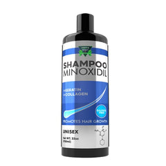 green royalty minoxidil shampoo bottle showcasing sulfate-free daily cleansing